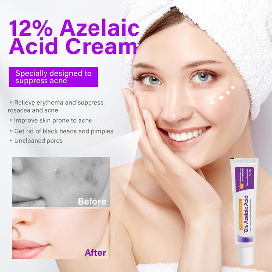 CalmGlow™ - Azelaic Acid Soothing Cream